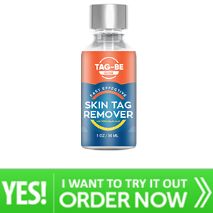 Tag Be Gone Skin Tag Remover
